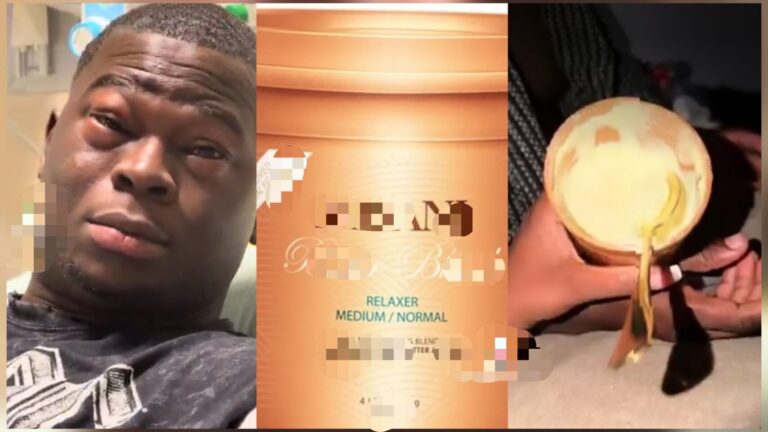 Man Accidentally Consumes Hair Relaxer Stored in Fridge, Mistaking It for Ice Cream