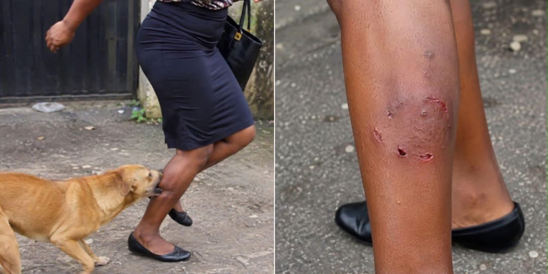 Nigerian man distressed after neighbour's dog bites wife